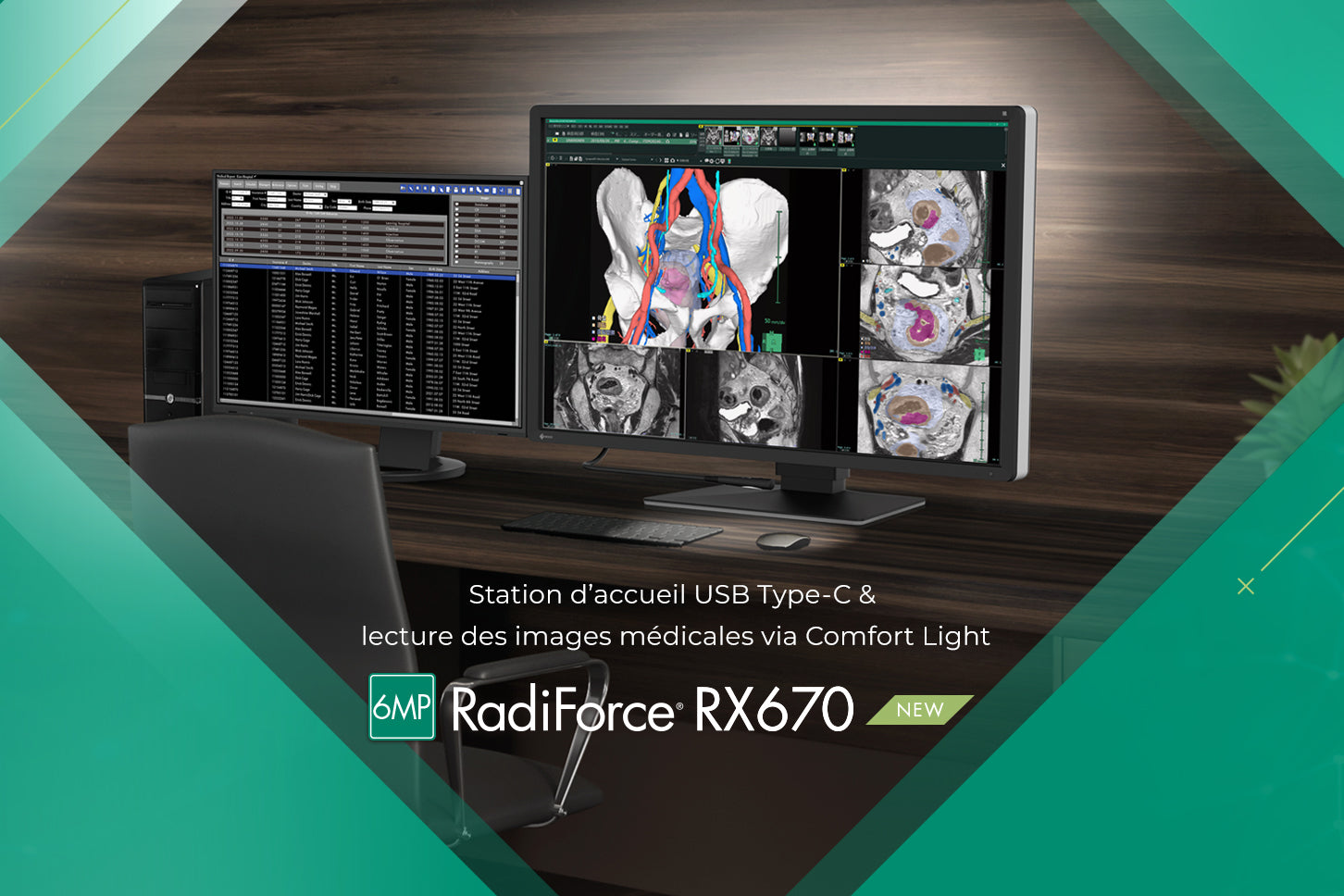 EIZO RX670 : moniteur médical 6MP, confort et précision