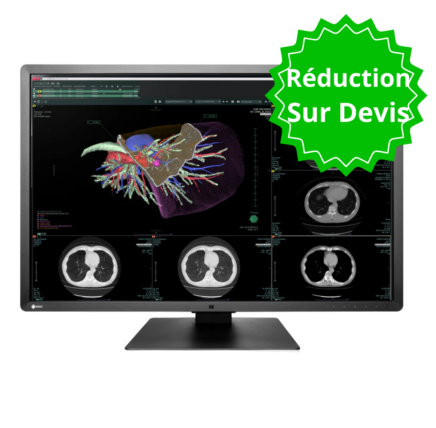 RadiForce 30p RX660 - Noir