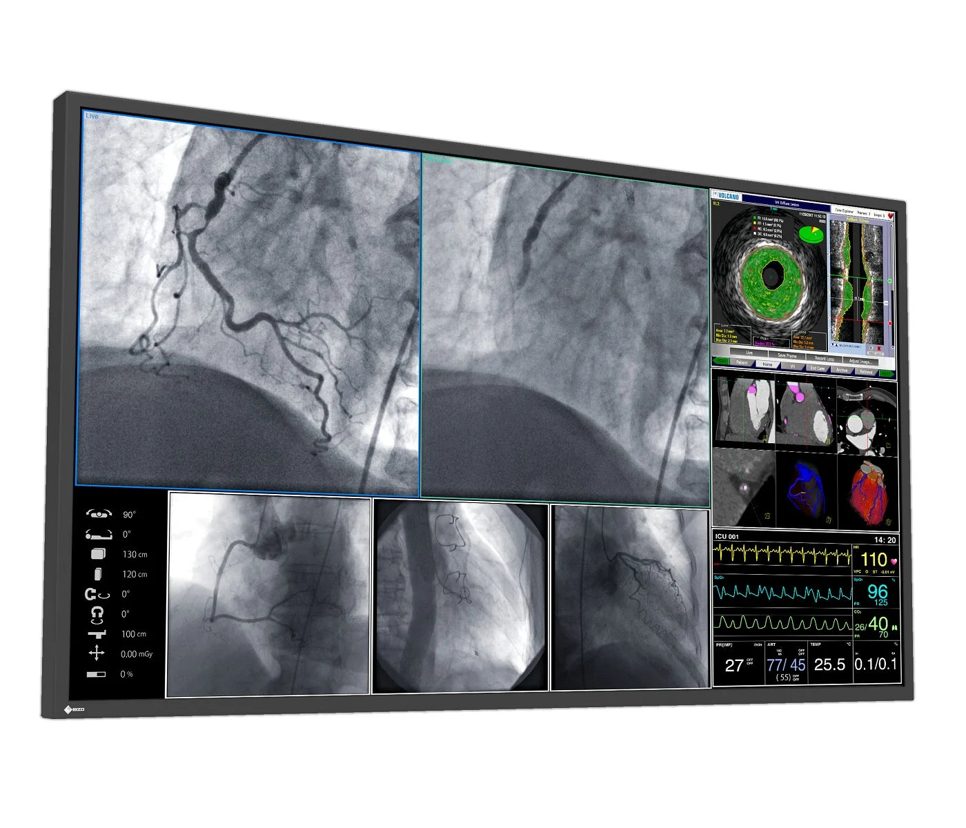 CuratOR 55p 4K UHD LL550W