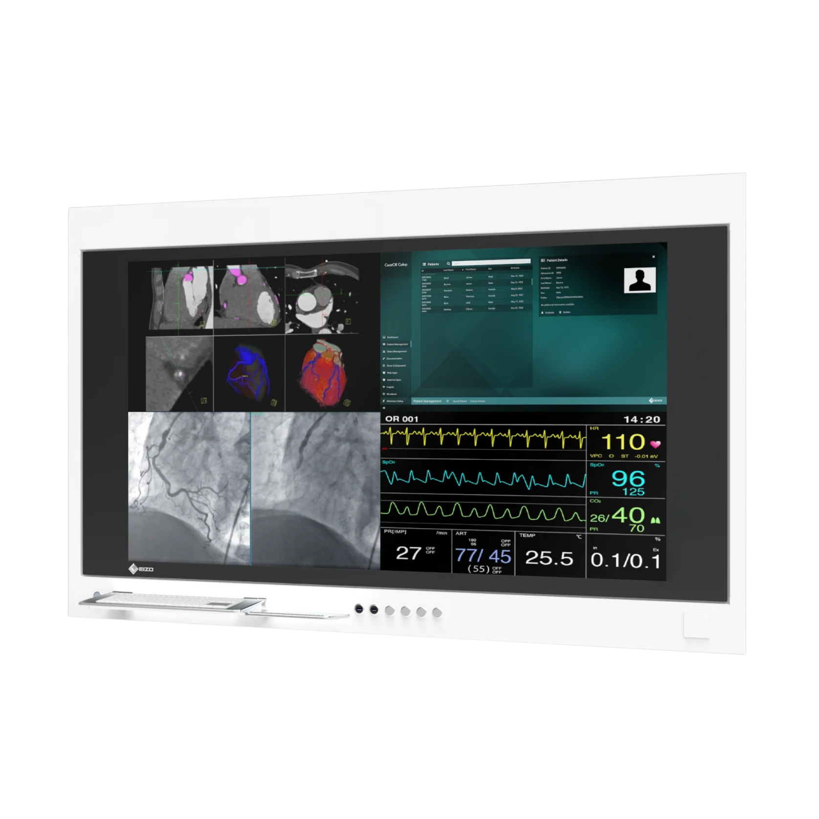 EIZO CuratOR 65p Panel chirurgical SP1-654K