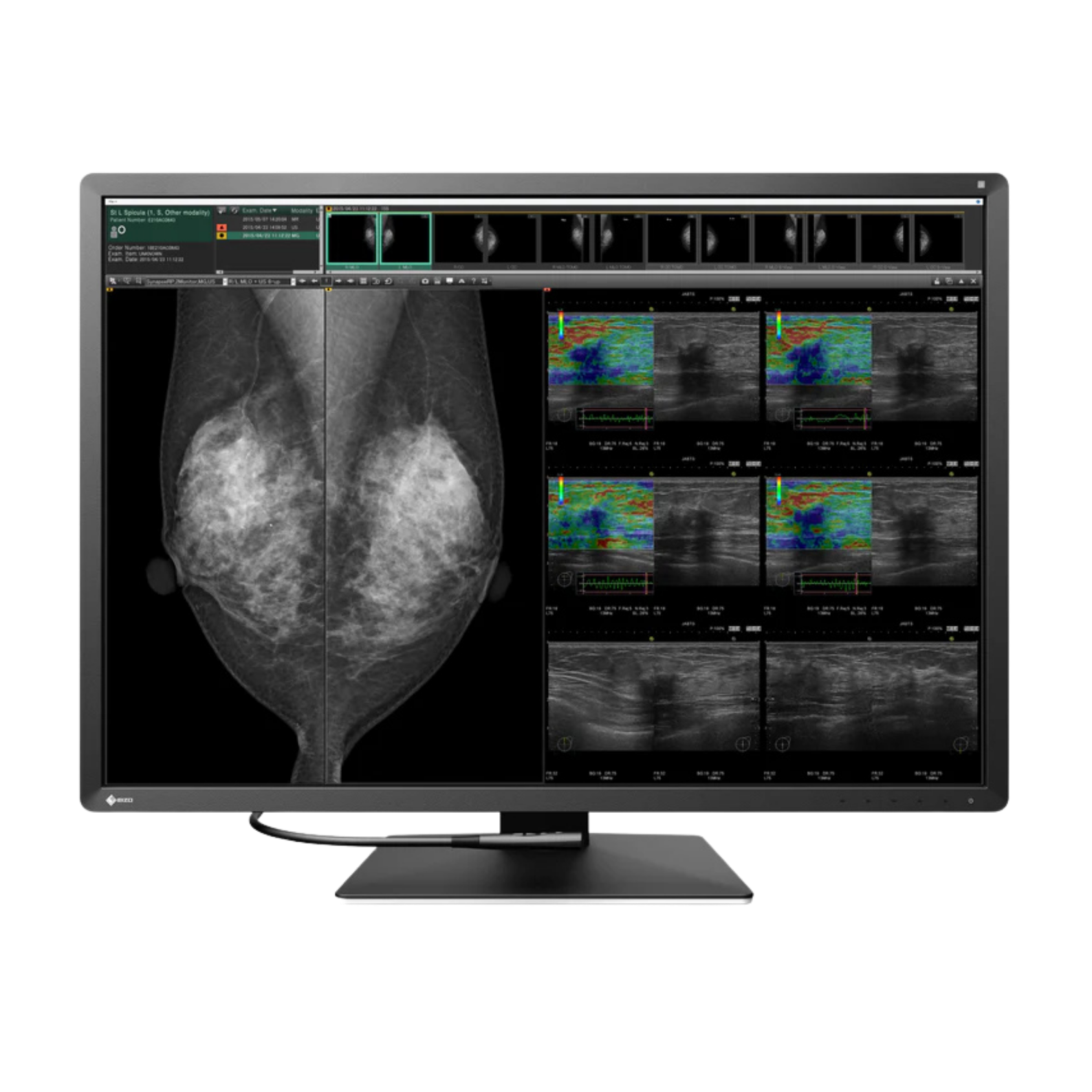 RadiForce 31p RX1270