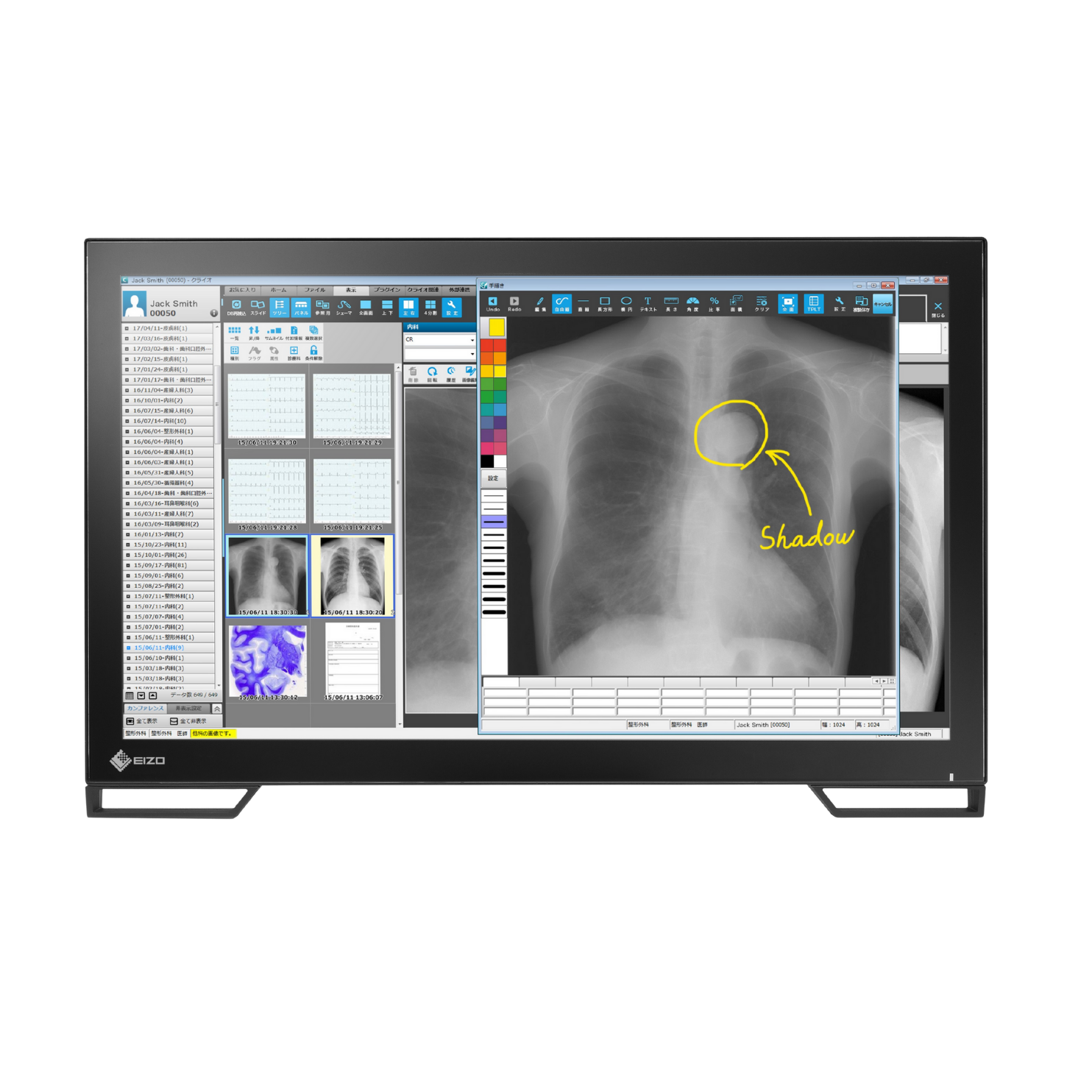 RadiForce 23p MS236WT-A