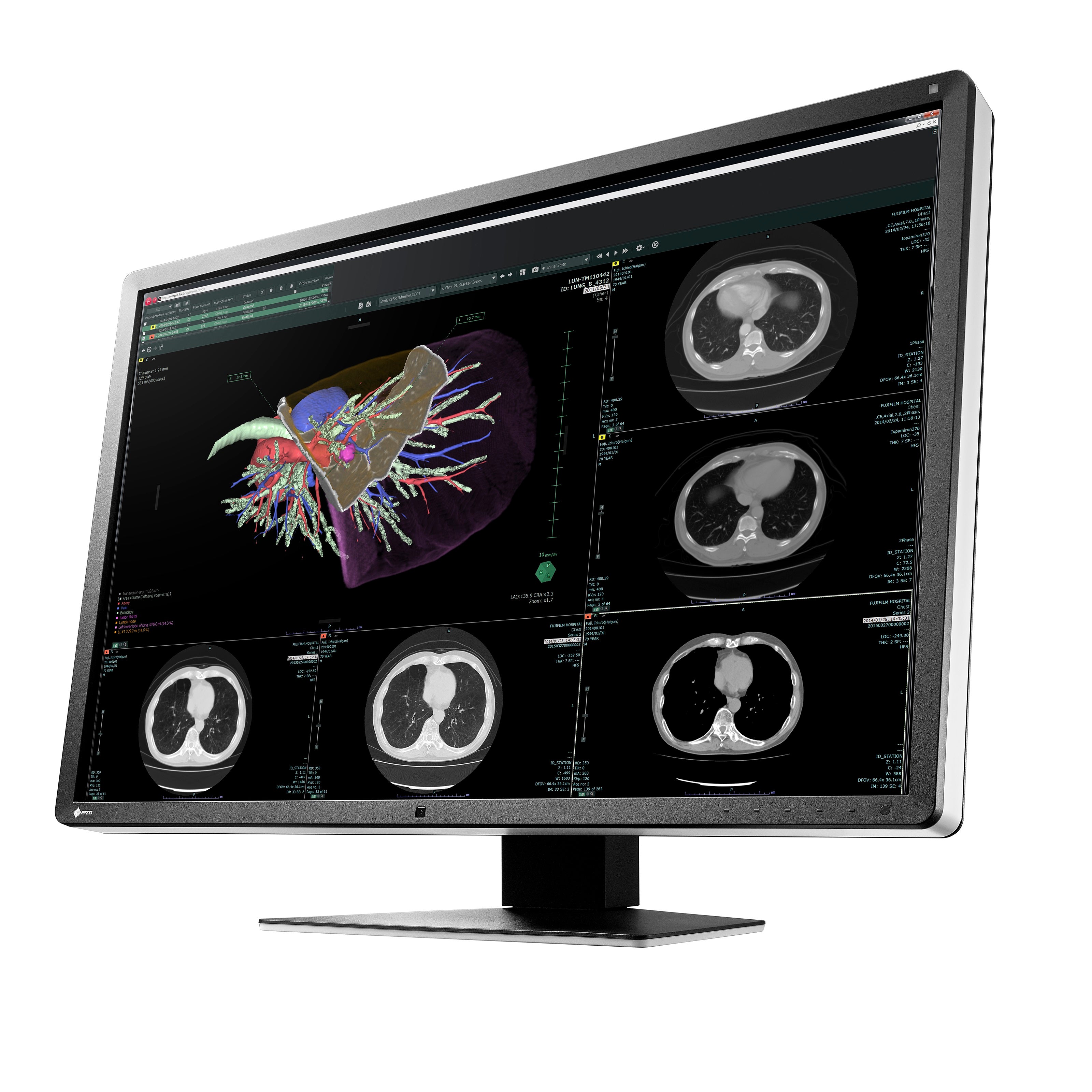 RadiForce 30p RX660