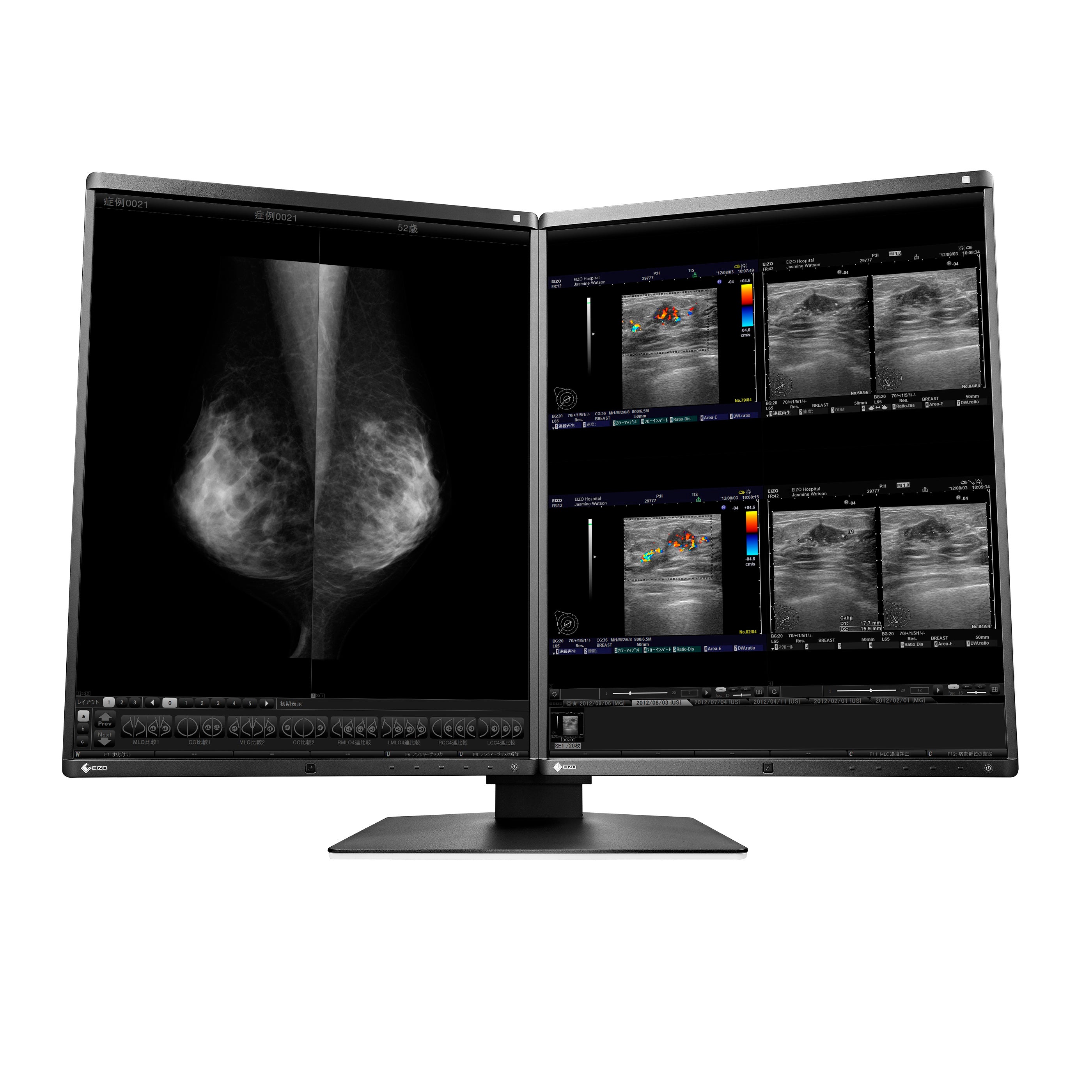 RadiForce 21p RX560-MD