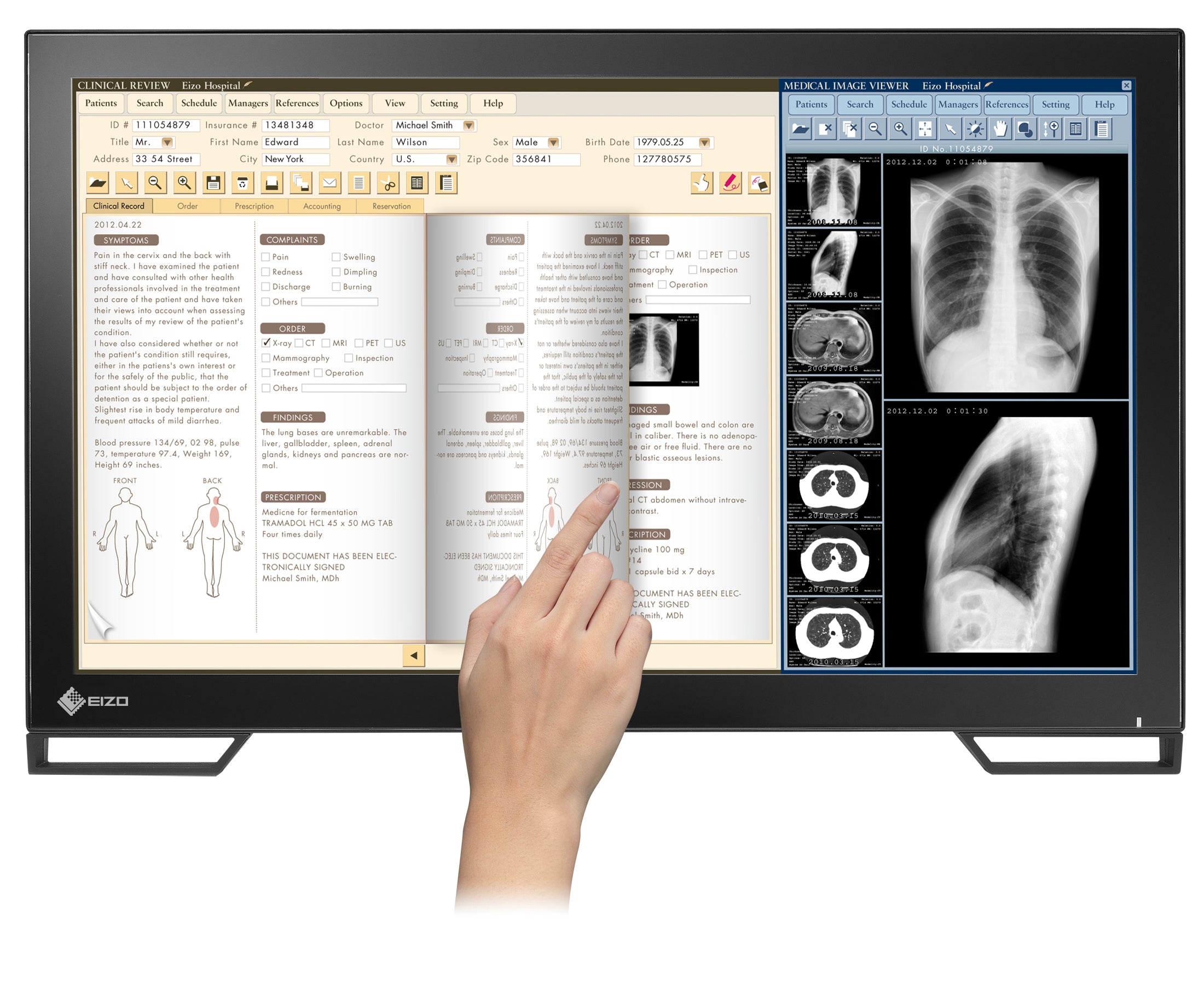 RadiForce 23p MS236WT-A