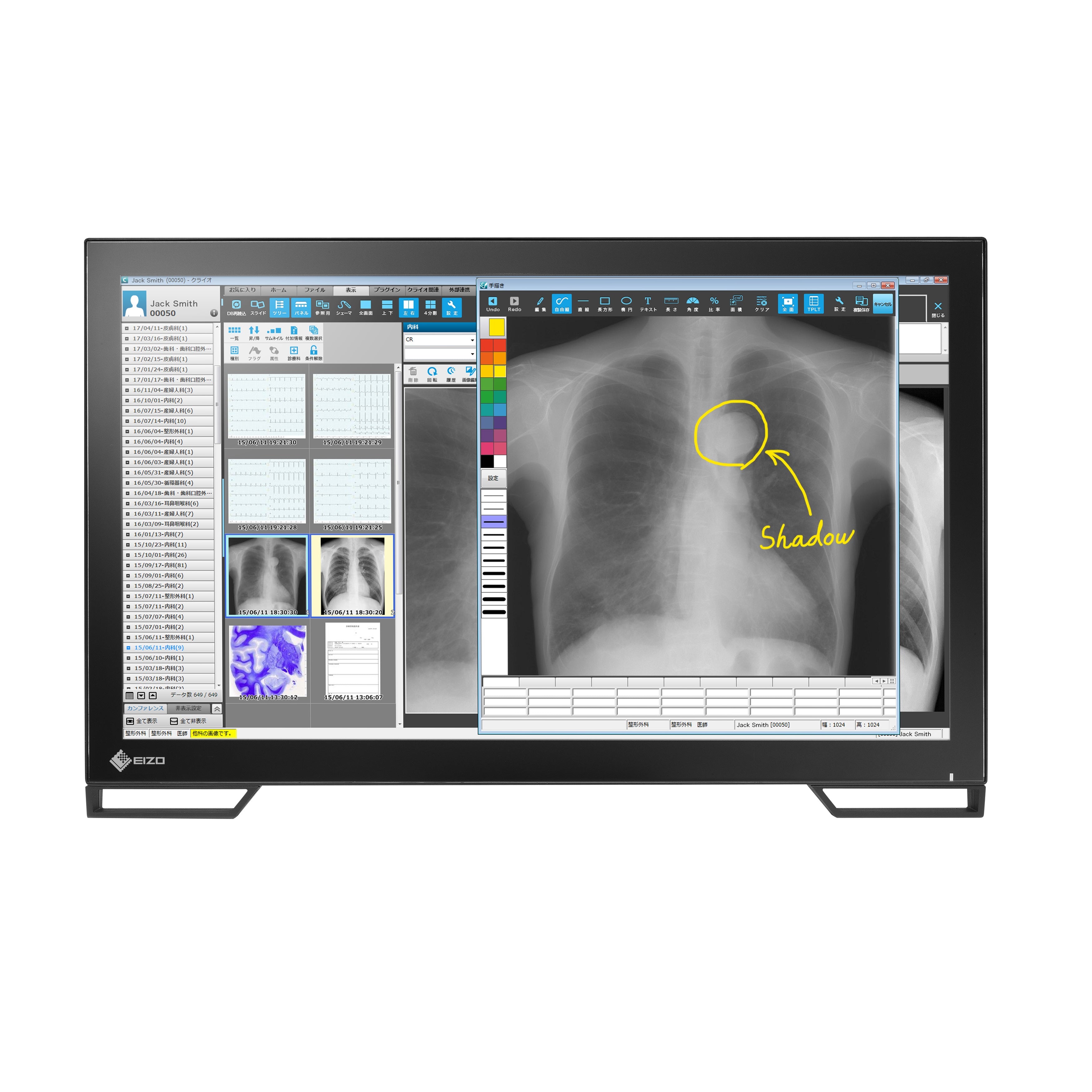 RadiForce 23p MS236WT-A