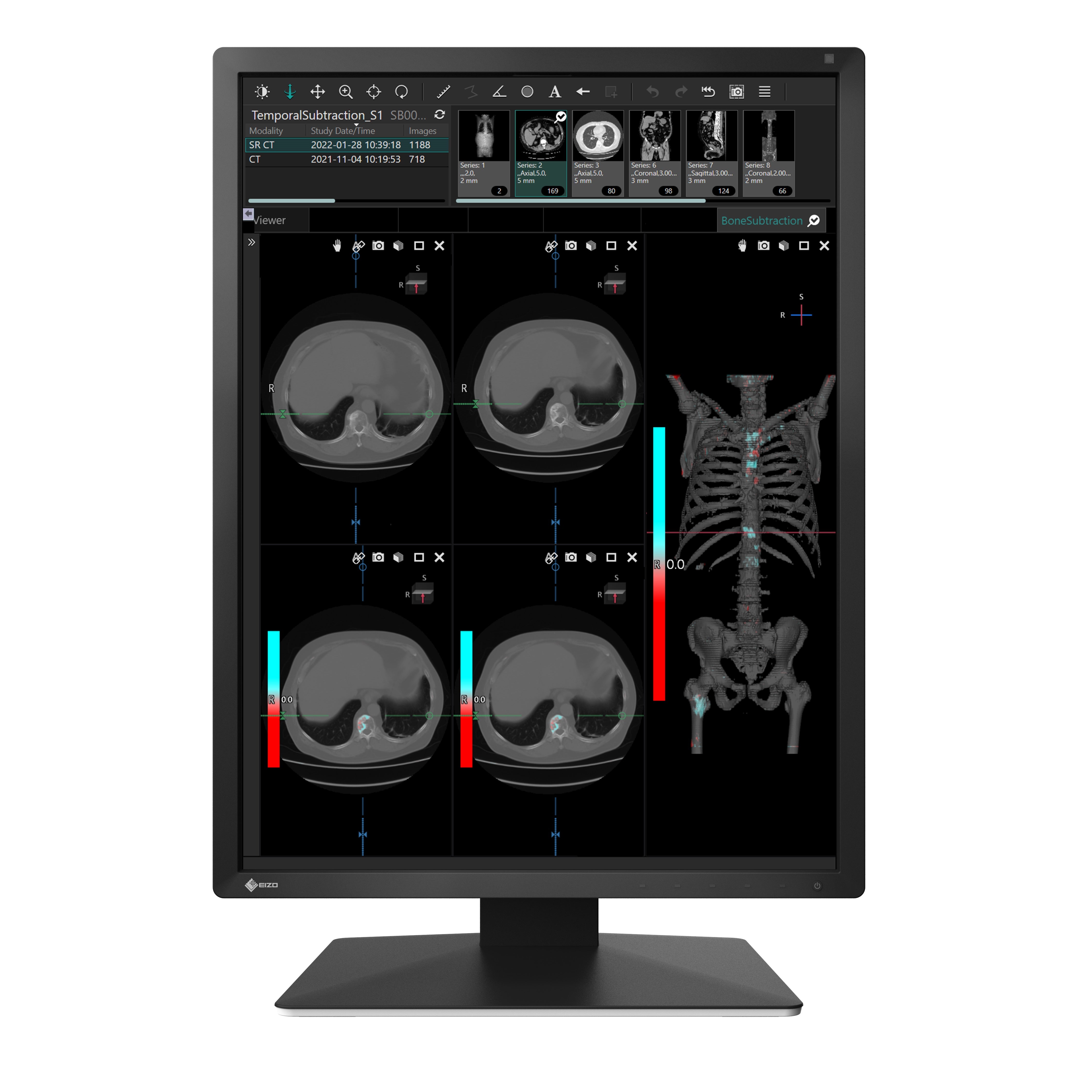 RadiForce 21p MX217