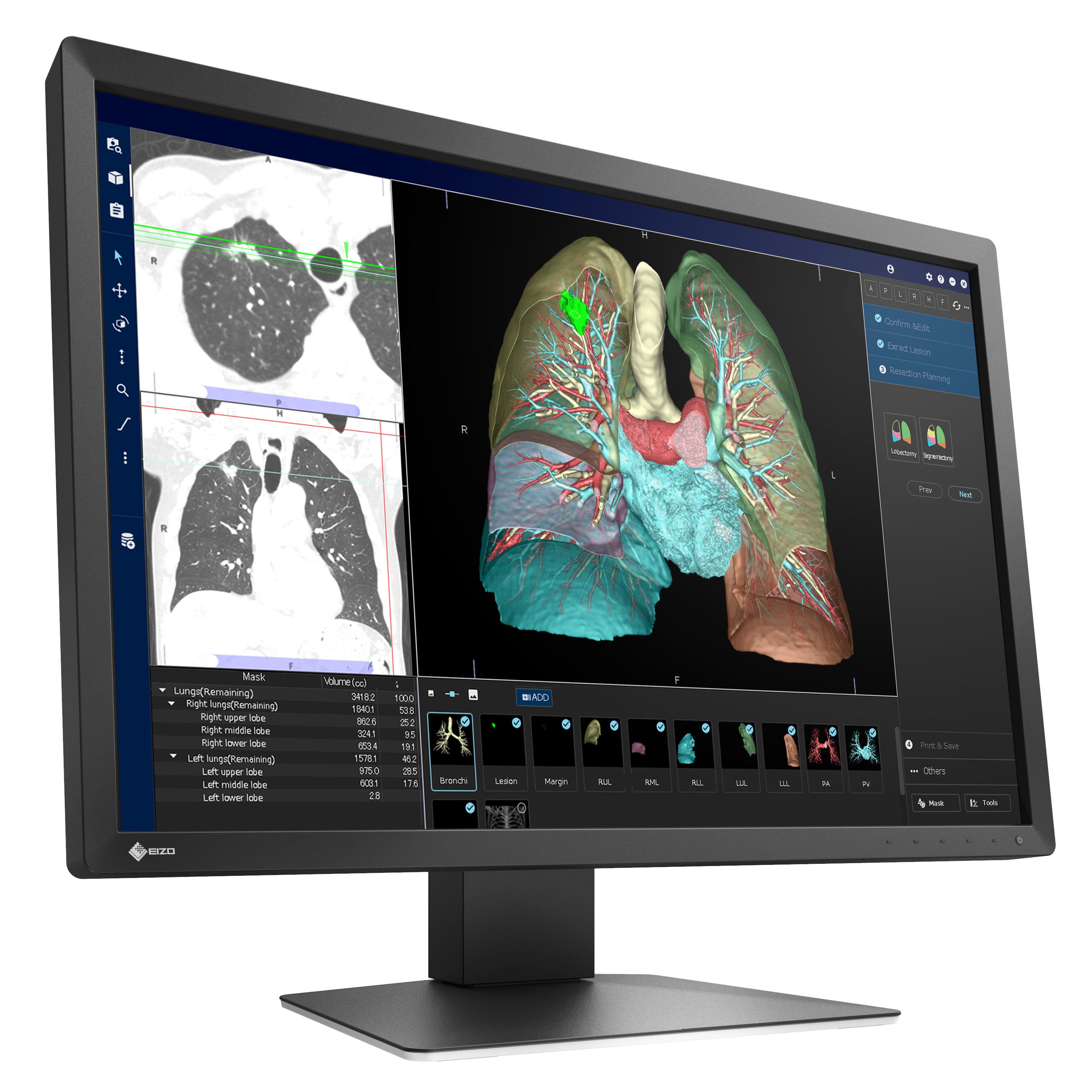 RadiForce 24p MX243W