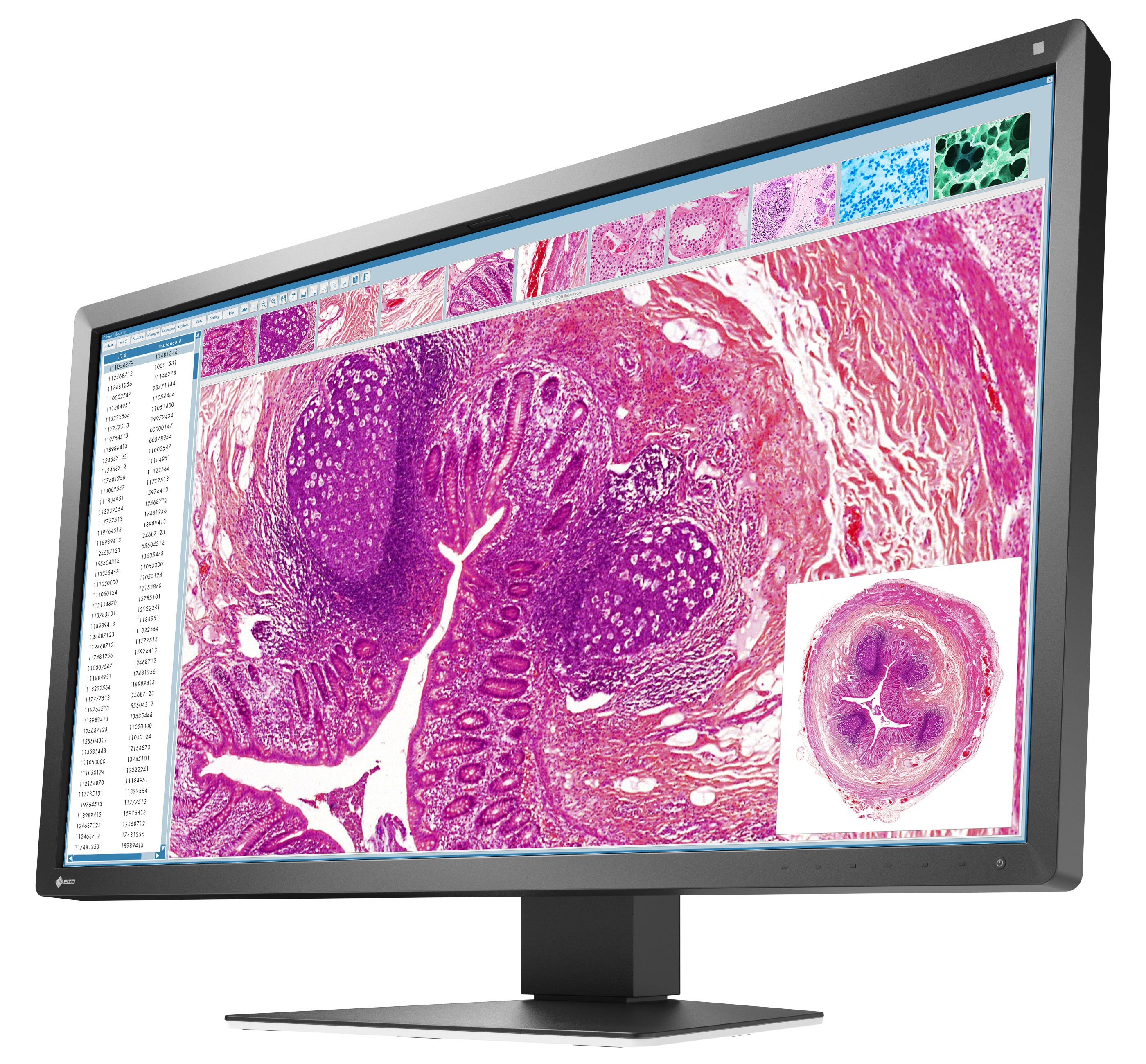 RadiForce 31p MX317W