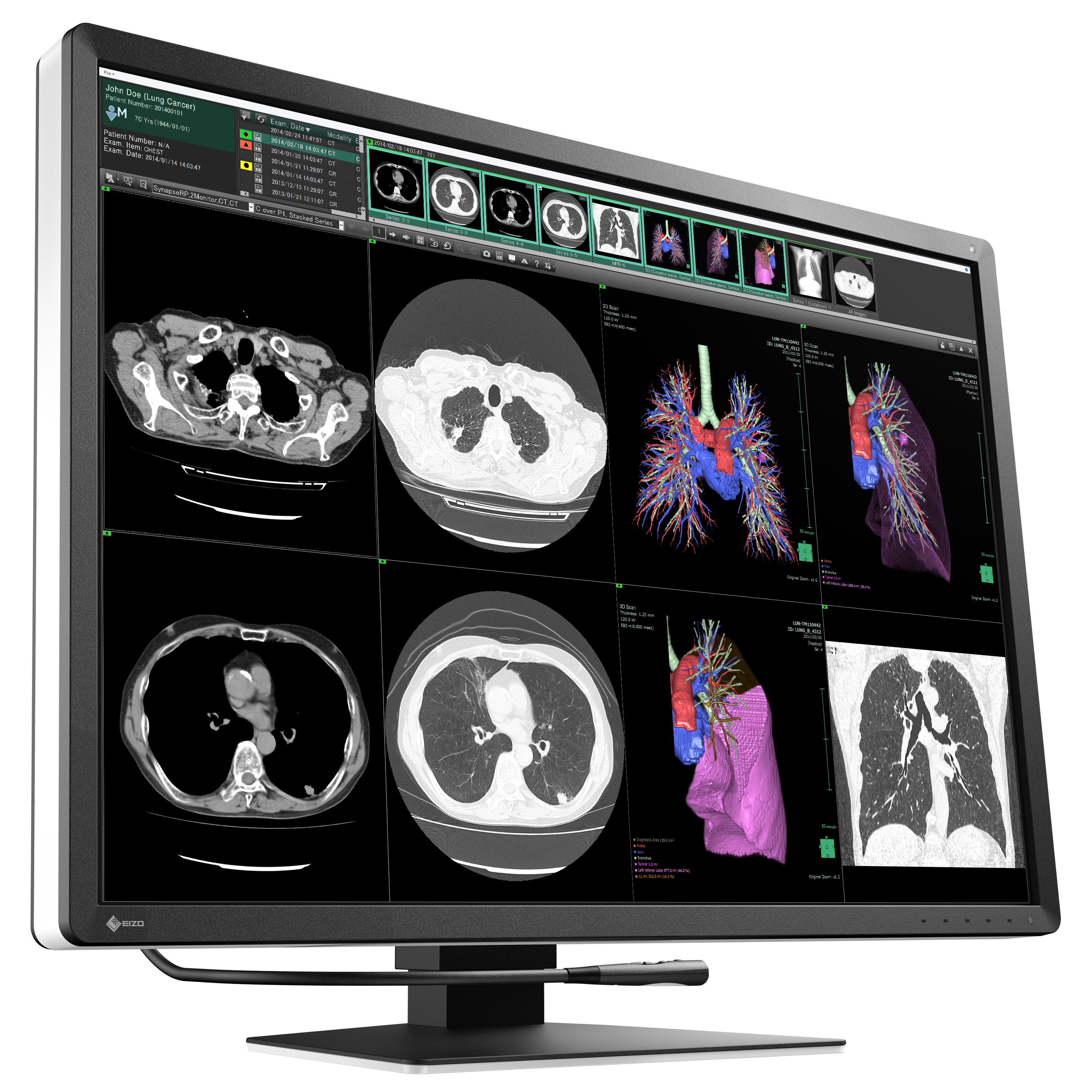 RadiForce 31p RX1270