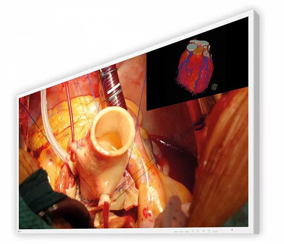 EIZO CURATOR MEDICAL MONITOR 43" 4K UHD EX4342