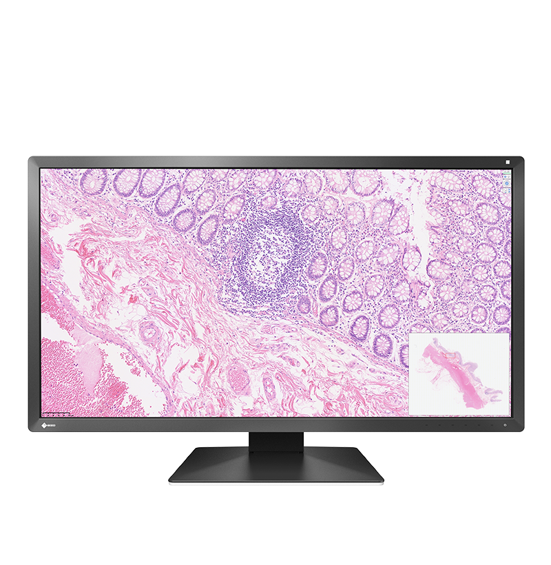 EIZO PX3150 – Écran de pathologie numérique
