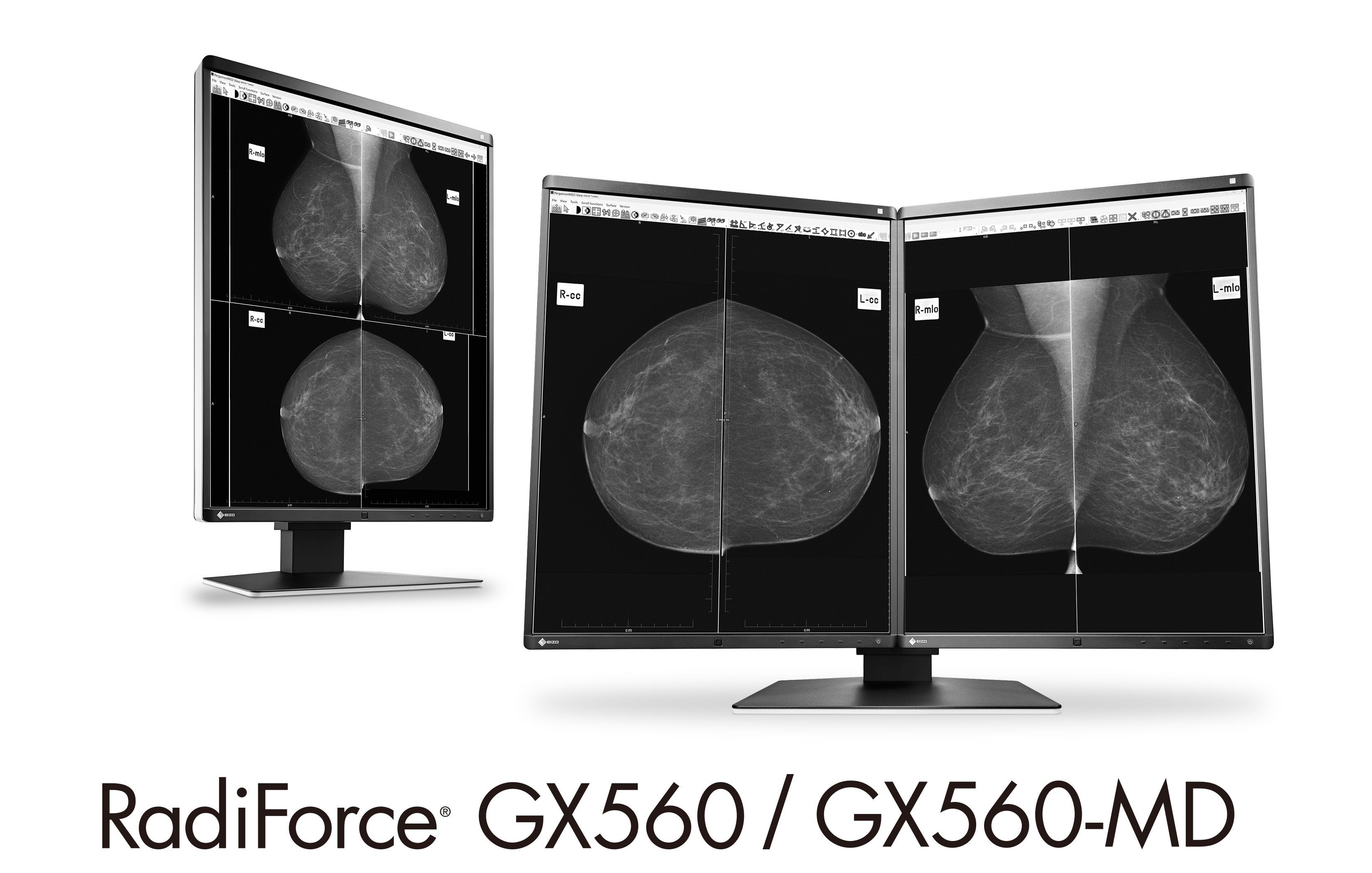 Ecran Eizo RadiForce GX560-MD
