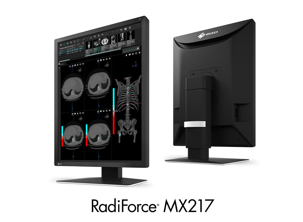 RADIFORCE 21P MX217