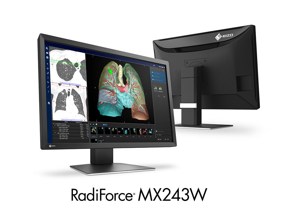 ECRAN EIZO RADIFORCE LCD 24 p COULEUR MX 243, CLINICAL REVIEW