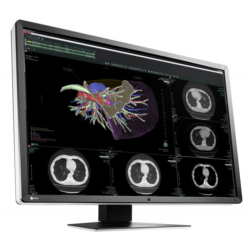 RADIFORCE 30P RX660