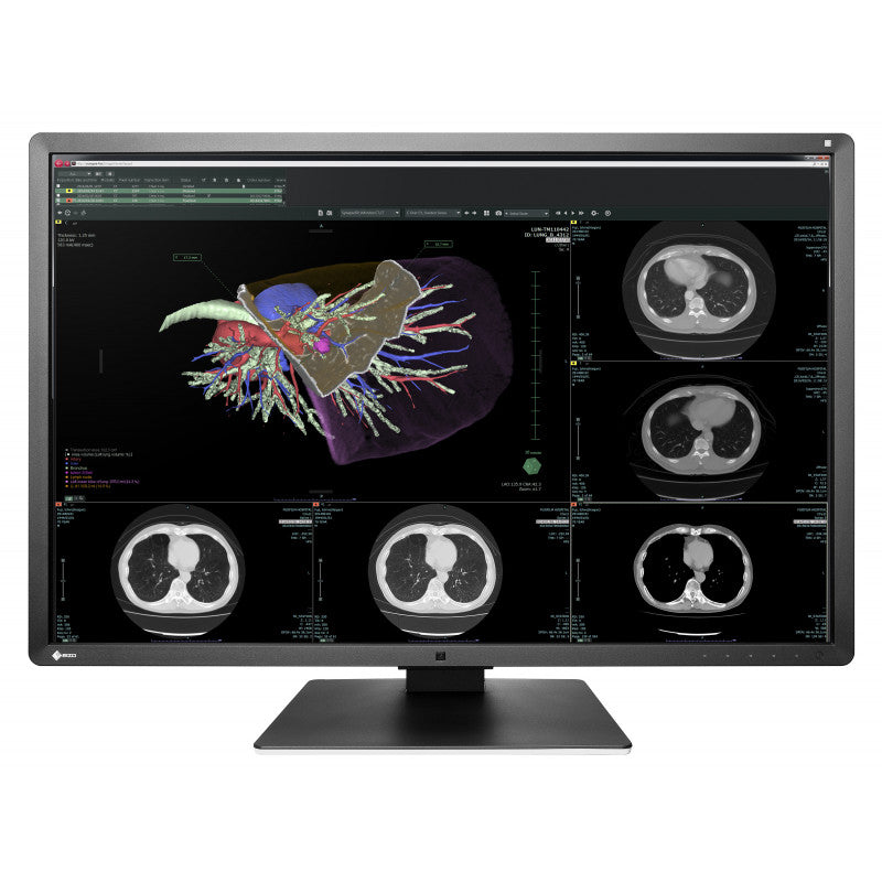 RADIFORCE 30P RX660
