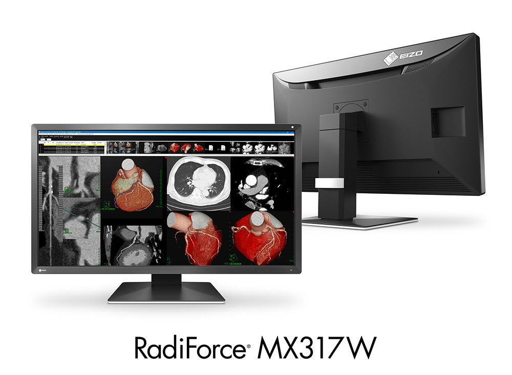 ECRAN EIZO RADIFORCE LCD 31,1p COULEUR MX317