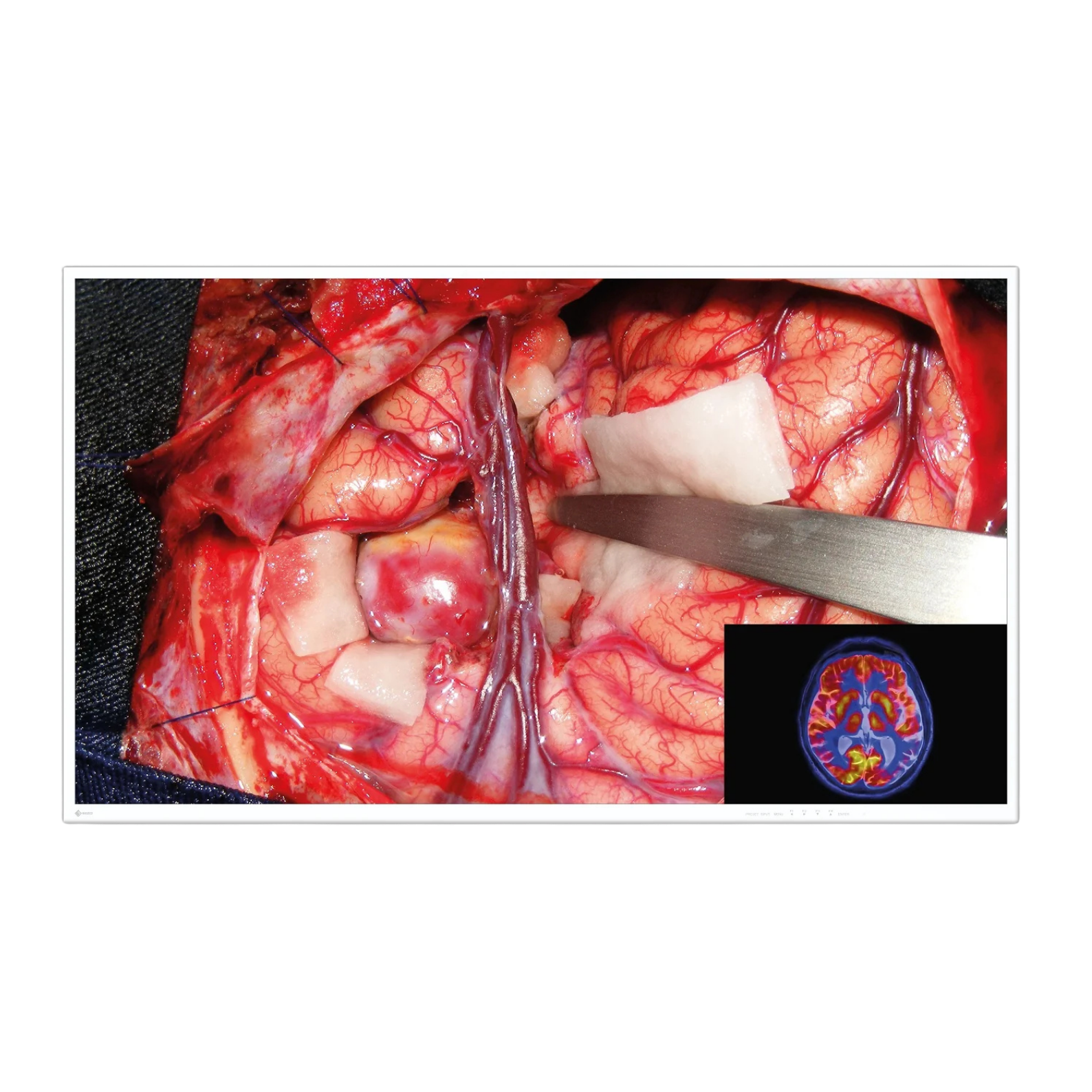 Chirurgie | Endoscopie