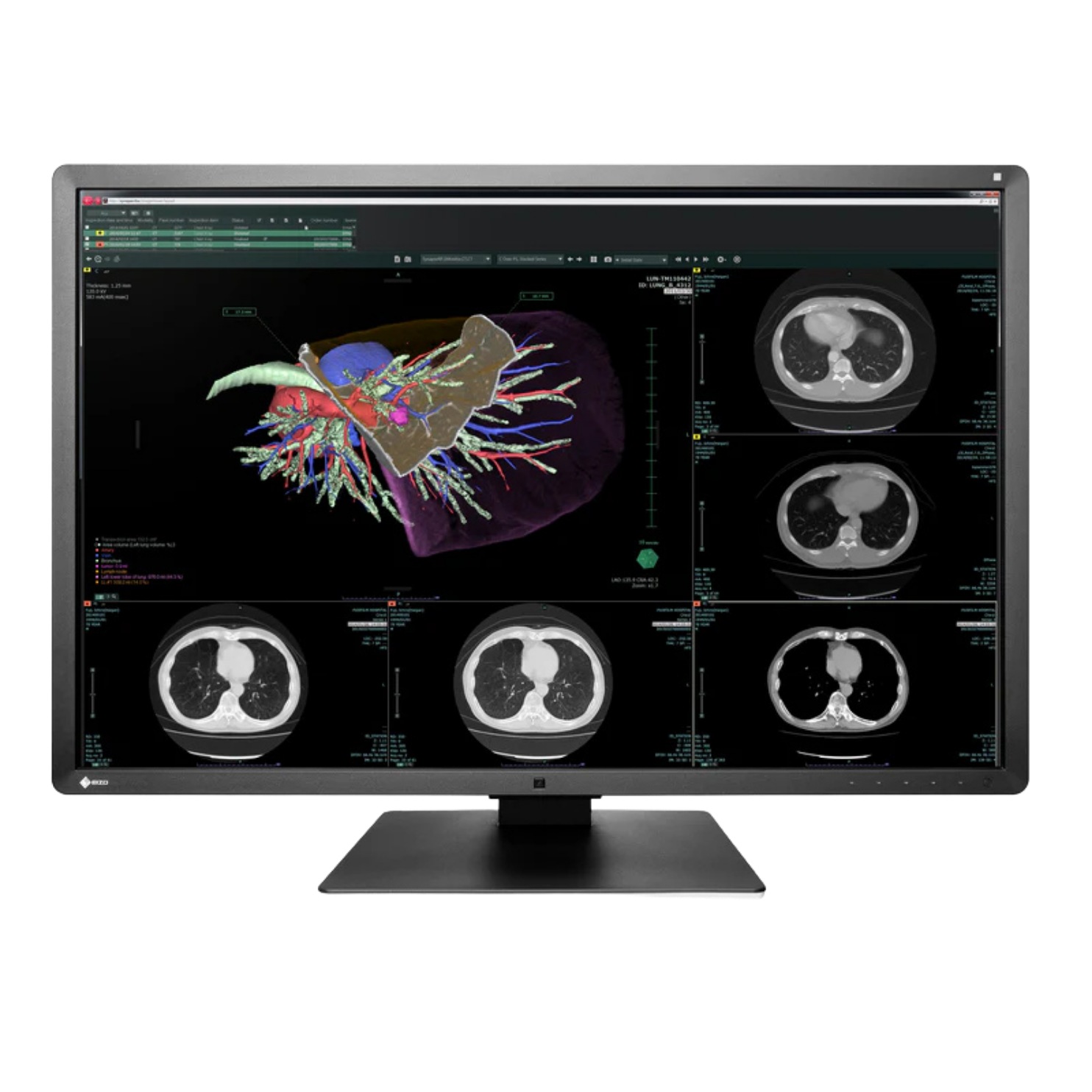 RadiForce 30p RX660 - Noir