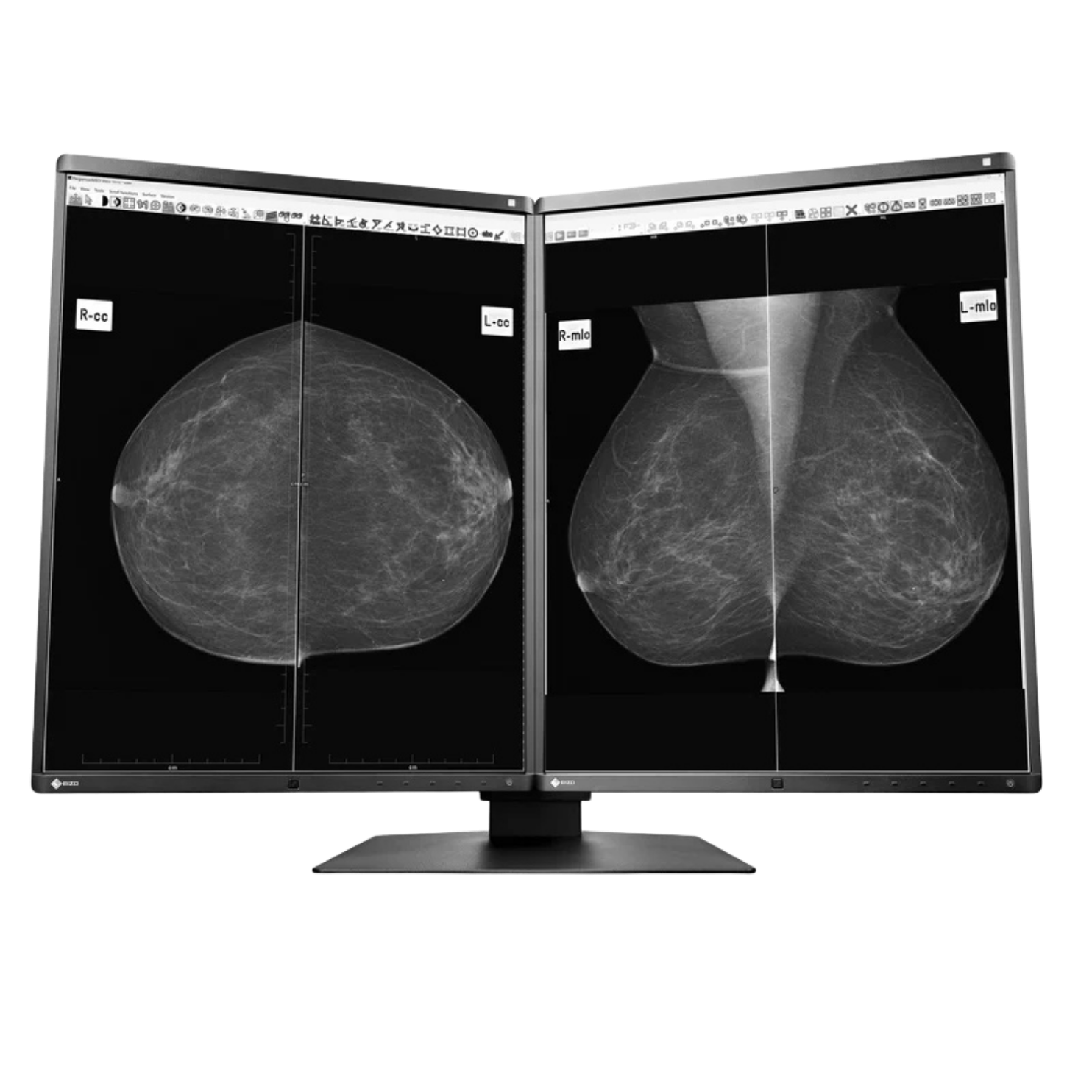 RadiForce Double 21p GX560-MD - noir