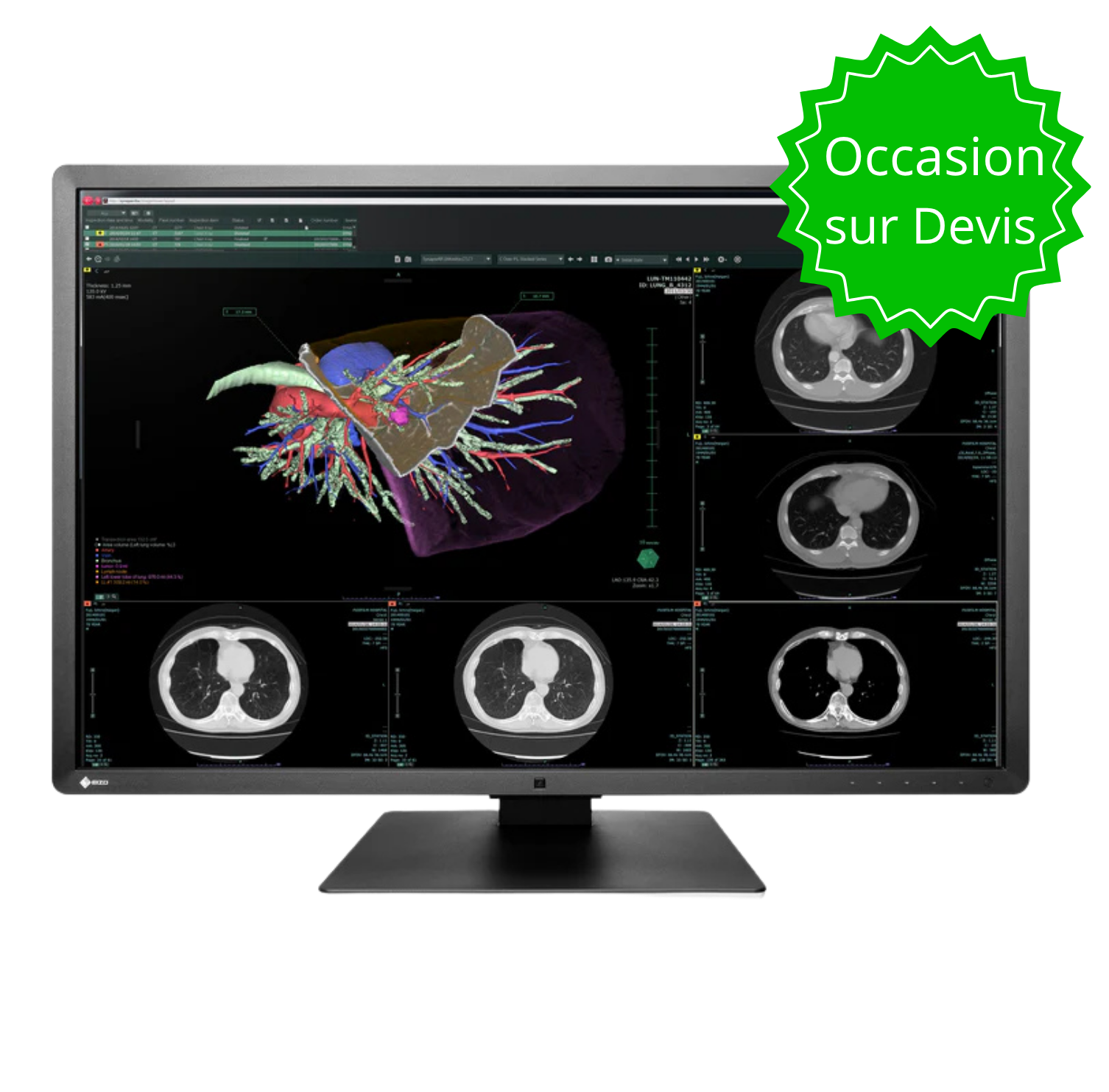 RadiForce 30p RX660 - Noir Occasion DEVIS
