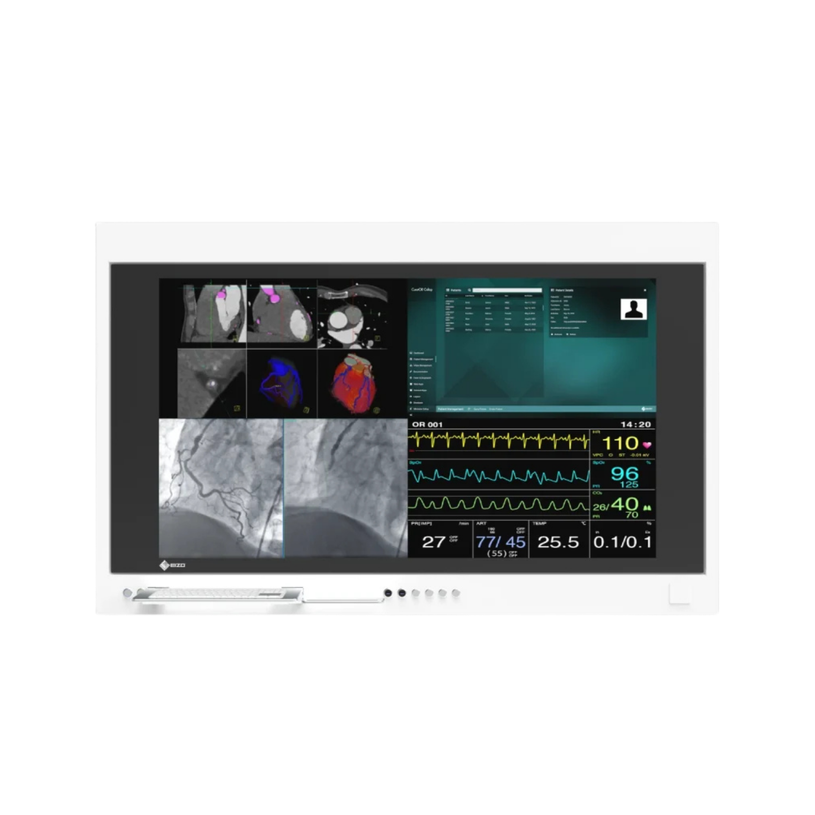 EIZO CuratOR 65p Panel chirurgical SP1-654K