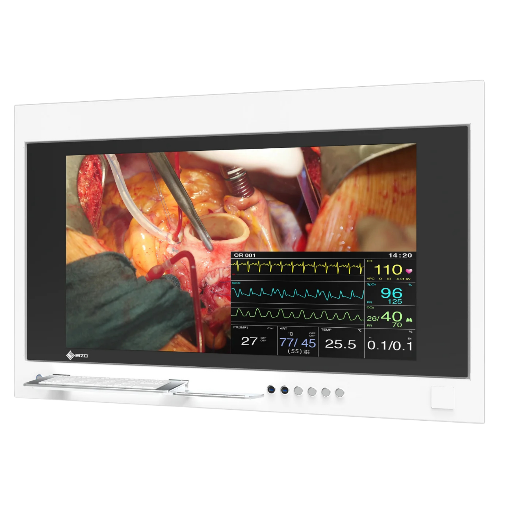 CuratOR - Panel Chirurgical SP1-494K