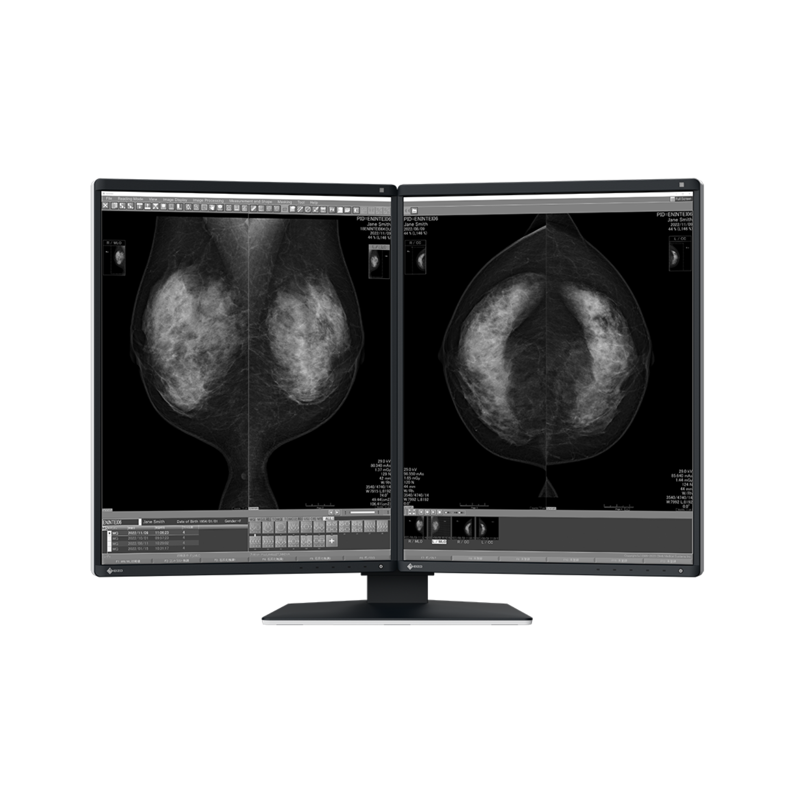 RadiForce 21p GX570-MD