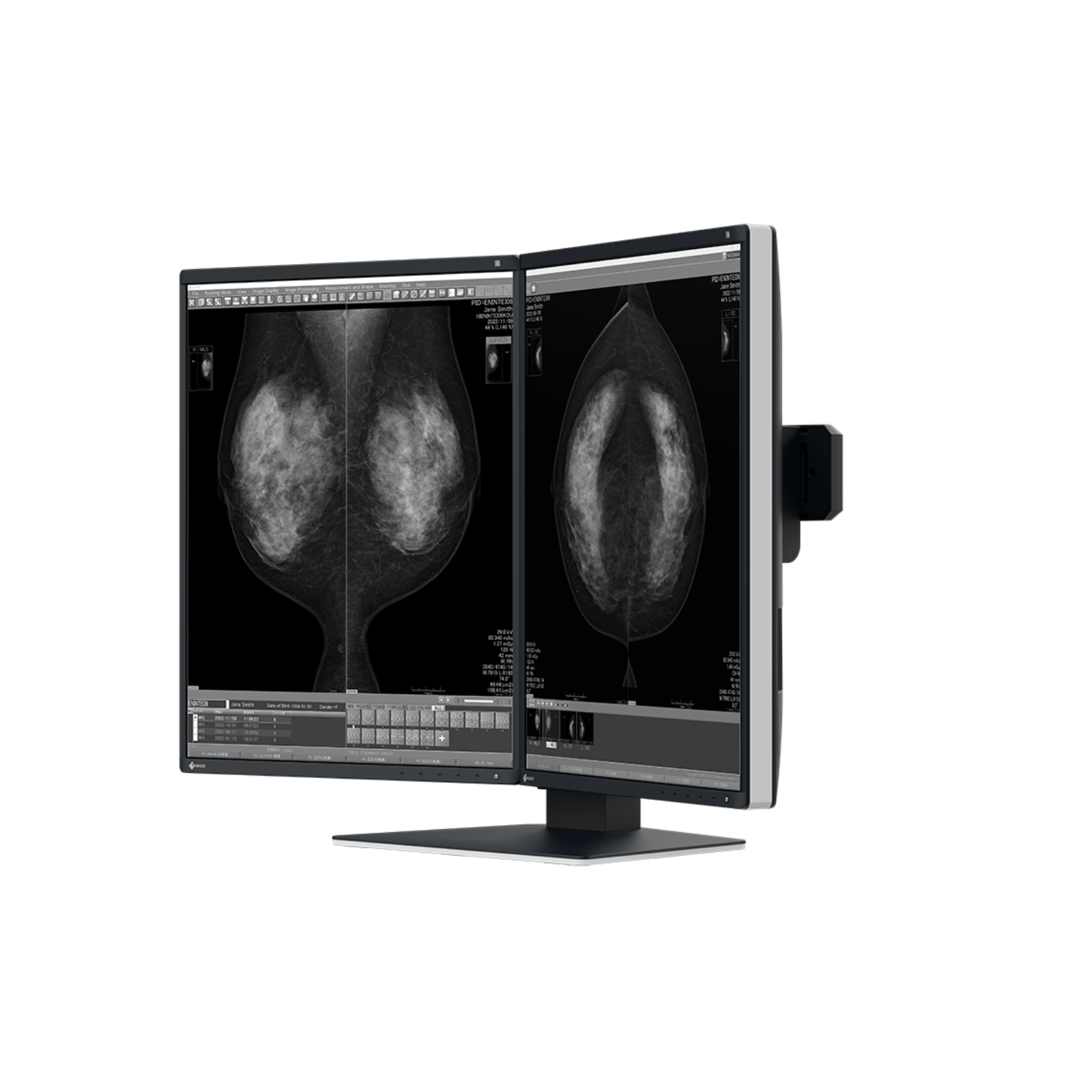 RadiForce 21p GX570-MD
