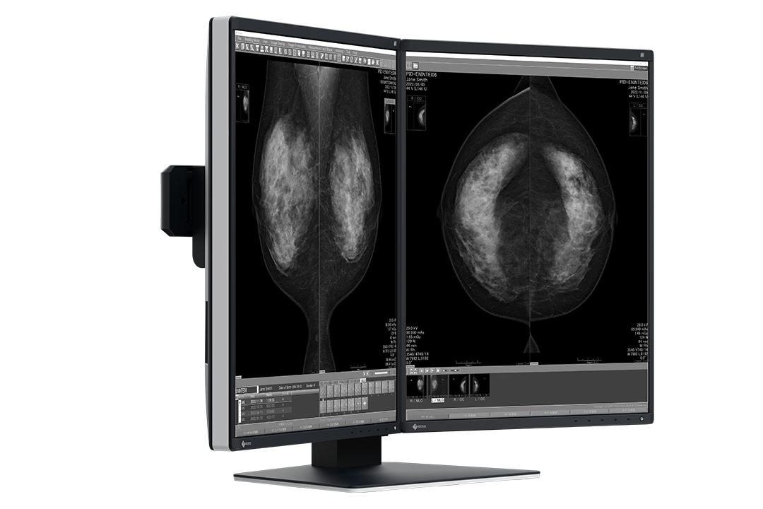 RadiForce 21p GX570-MD