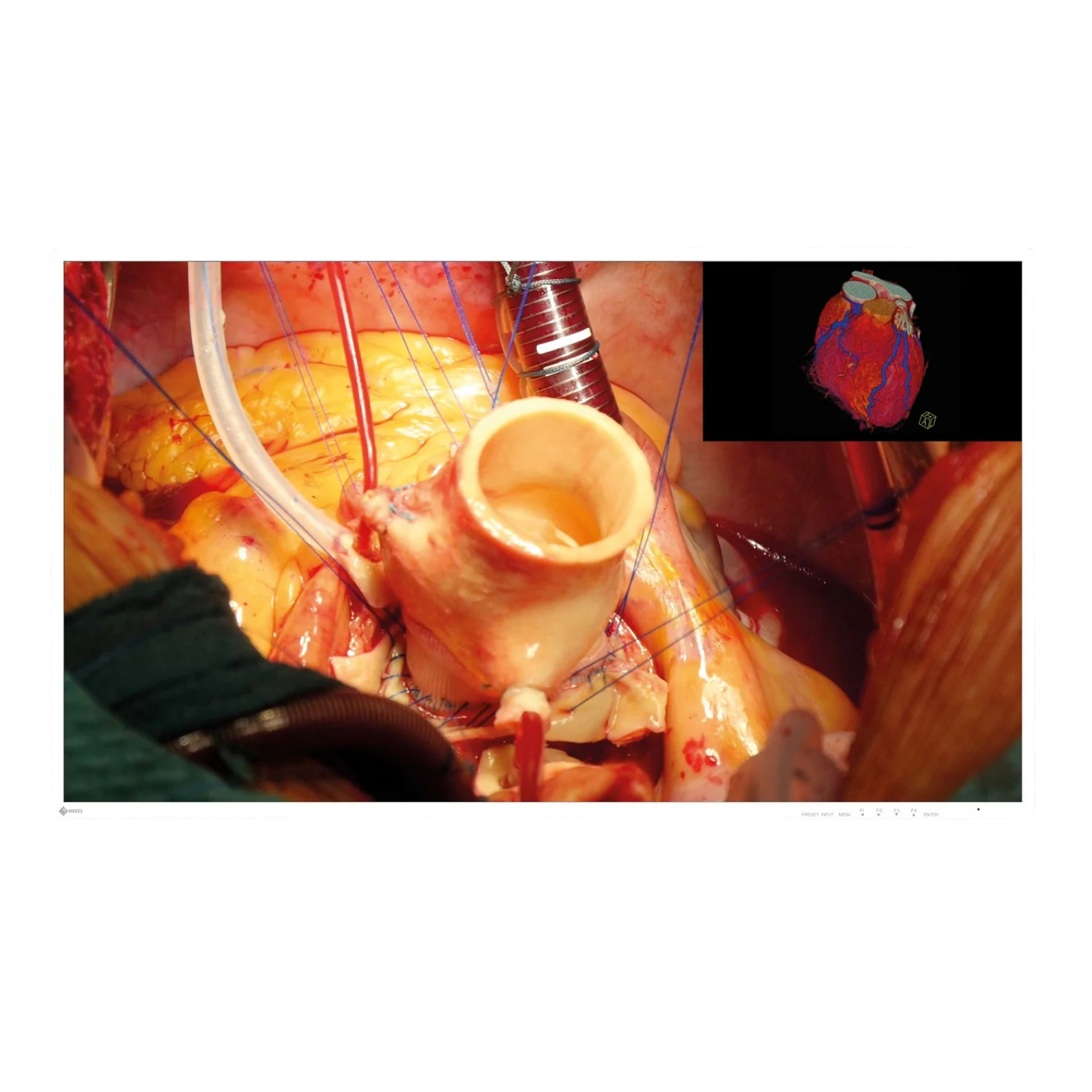 CuratOR 43p 4K UHD EX4342