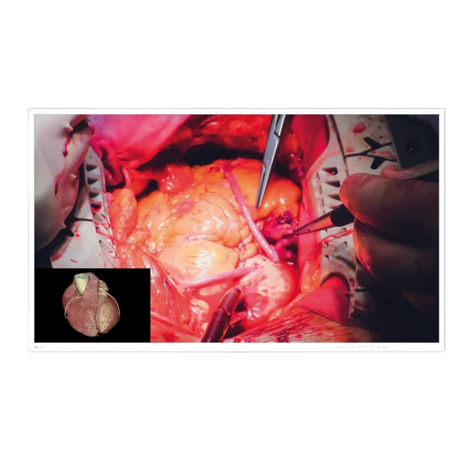 CuratOR 49p 4K UHD EX4942