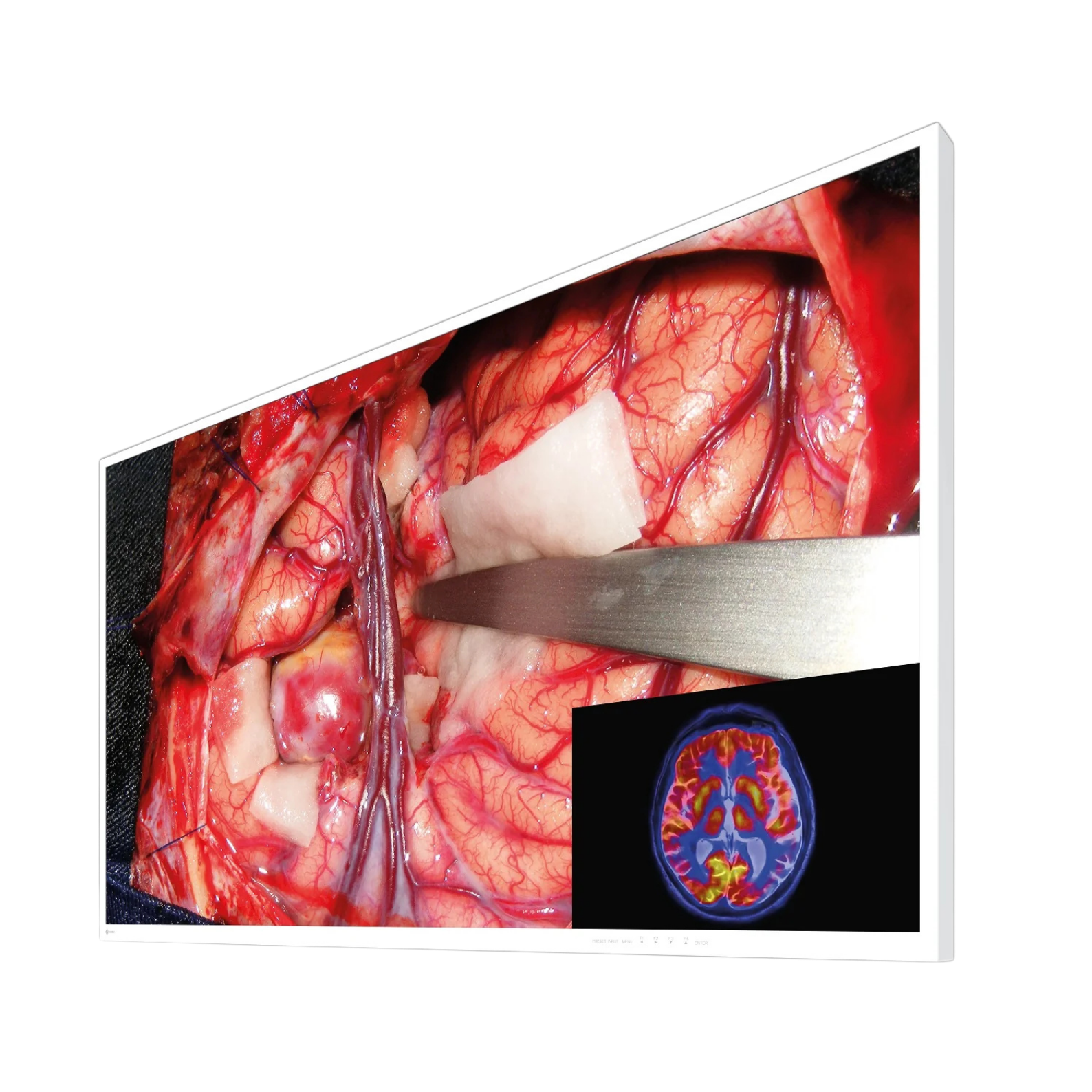 CuratOR 55p 4K UHD EX5542