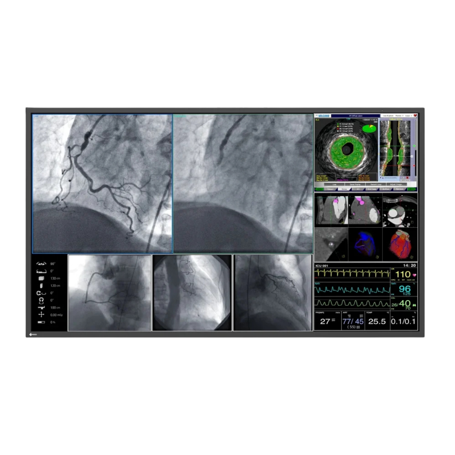 CuratOR 55p 4K UHD LL550W