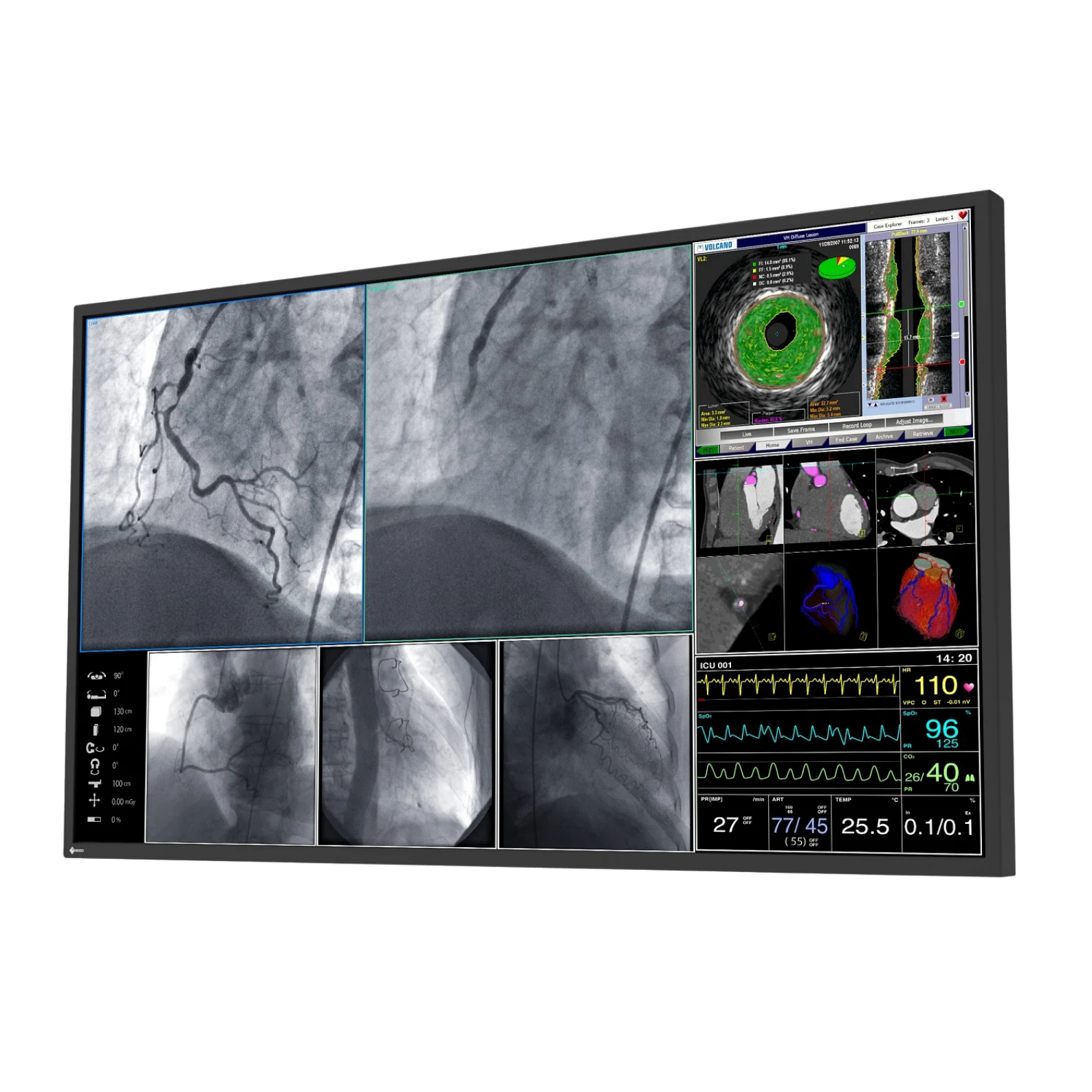 CuratOR 55p 4K UHD LL550W