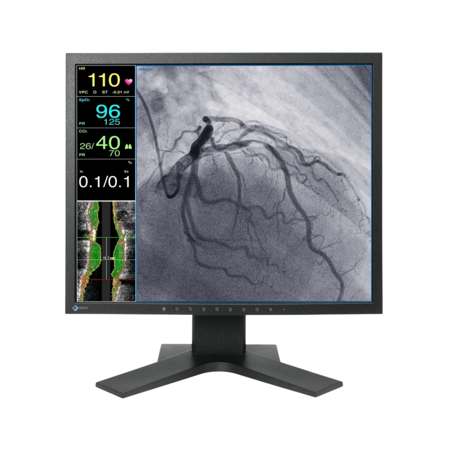 CuratOR 19p LCD LX1910