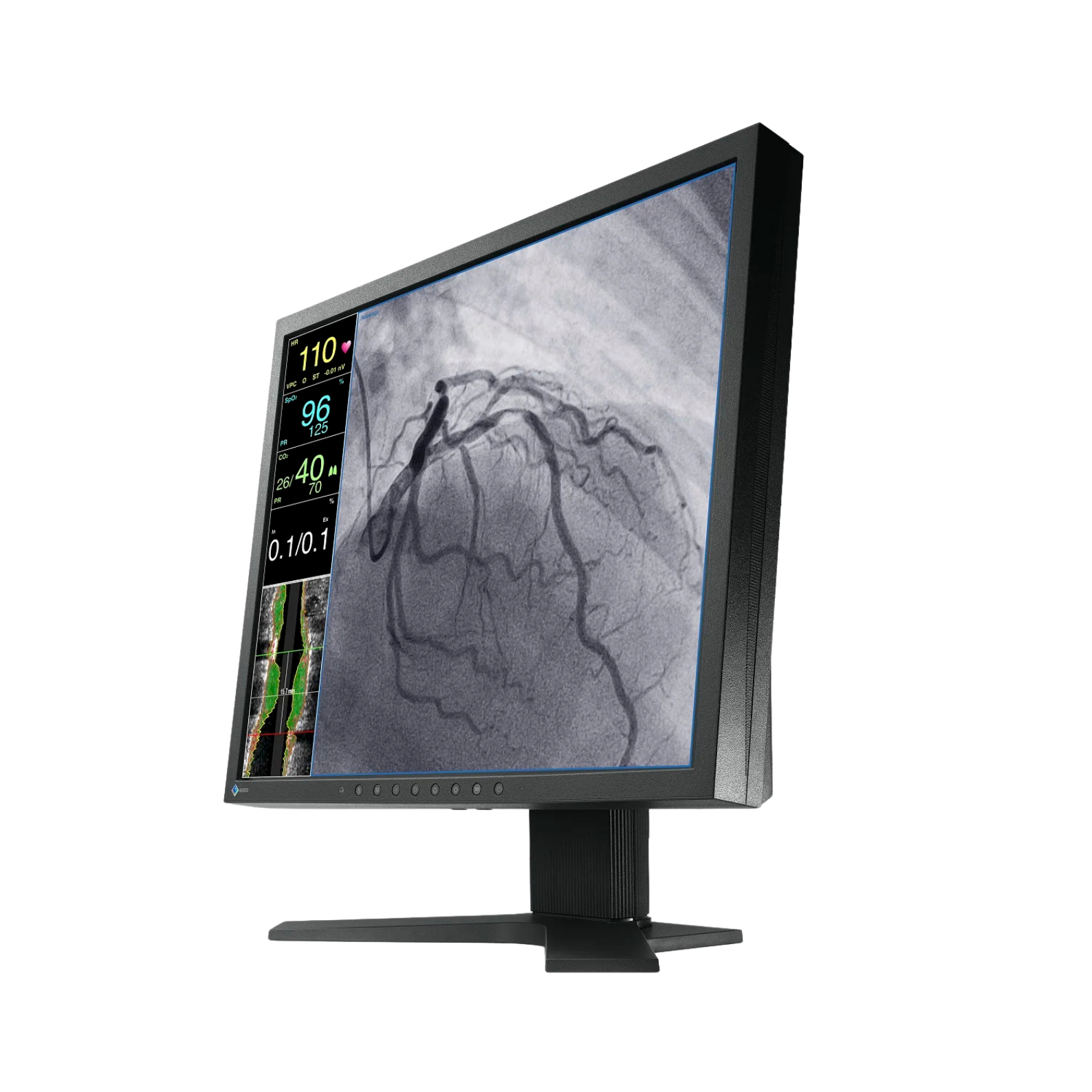 CuratOR 19p LCD LX1910