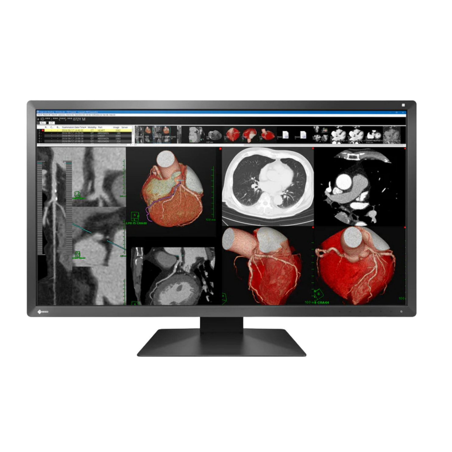 RadiForce 31p MX317W