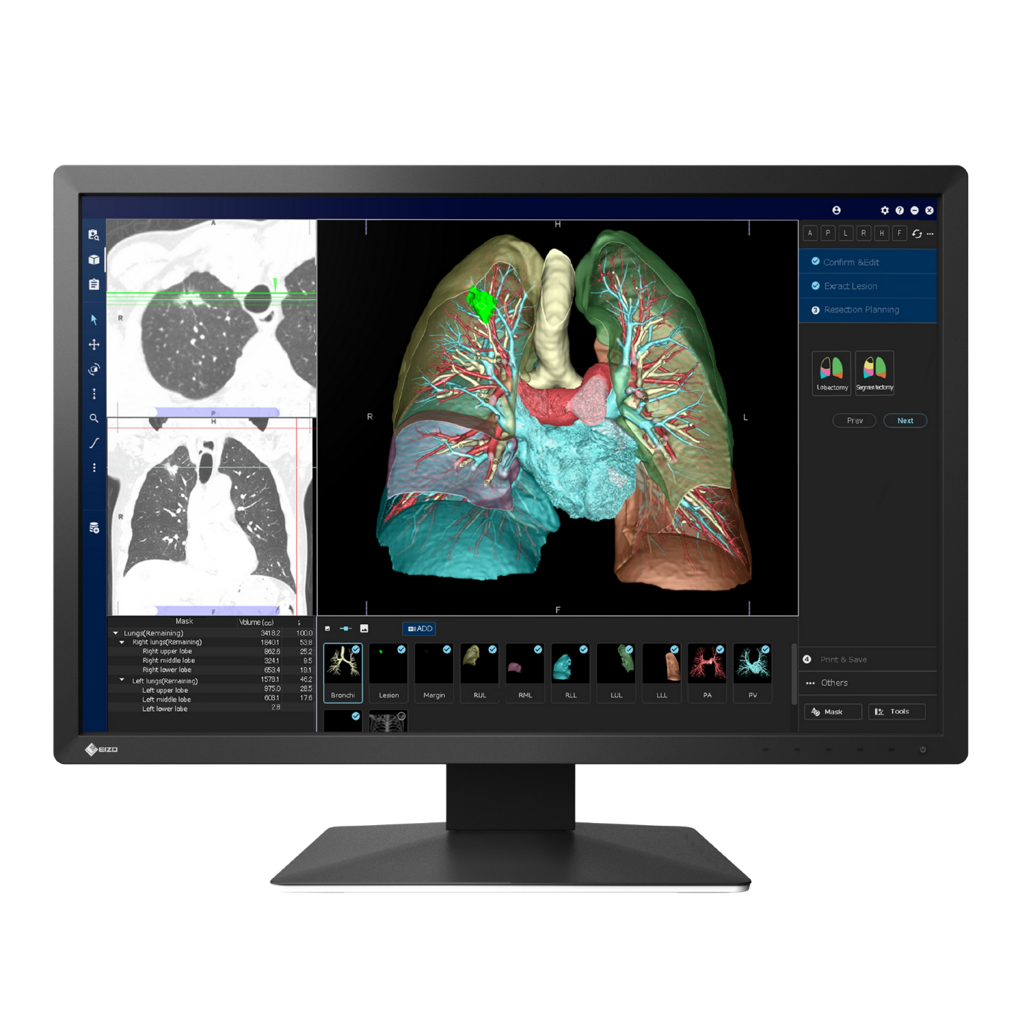 RadiForce 24p MX243W