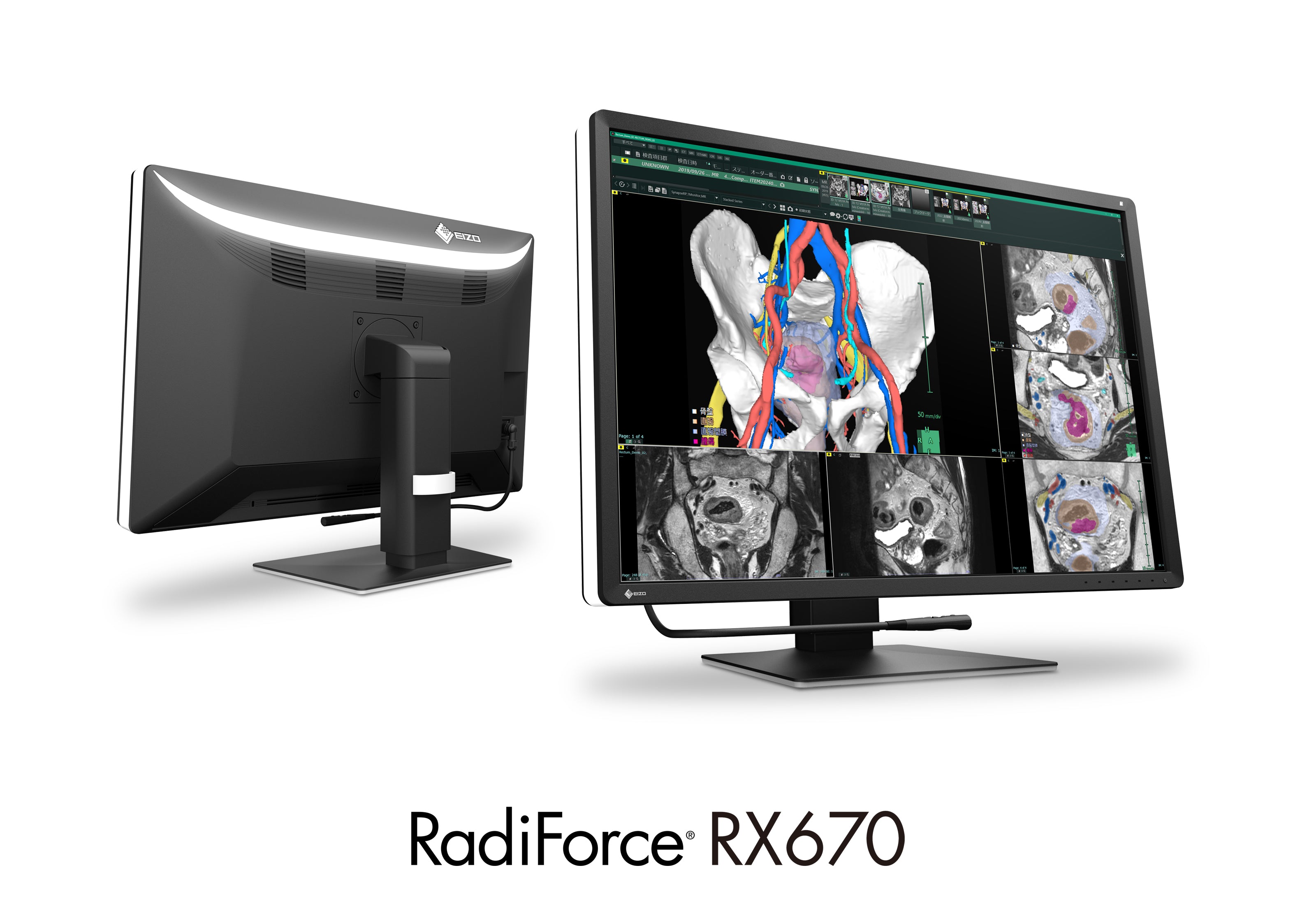 ECRAN EIZO RADIFORCE LCD 30p COULEUR RX670