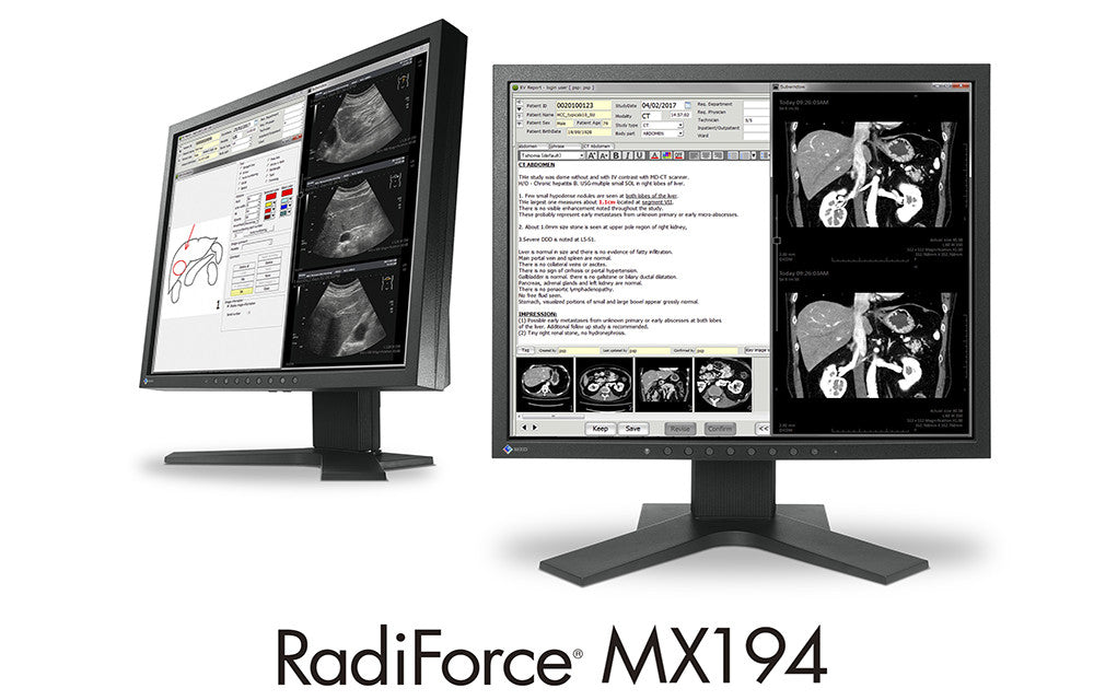 Ecran EIZO RadiForce MX194